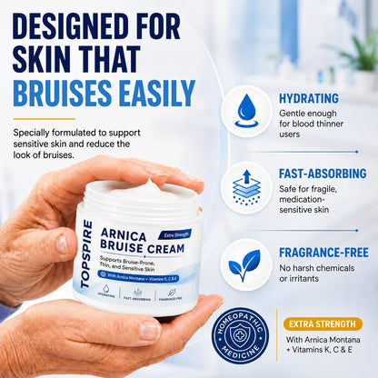 💕 TOPSPIRE® Arnica Bruise Cream