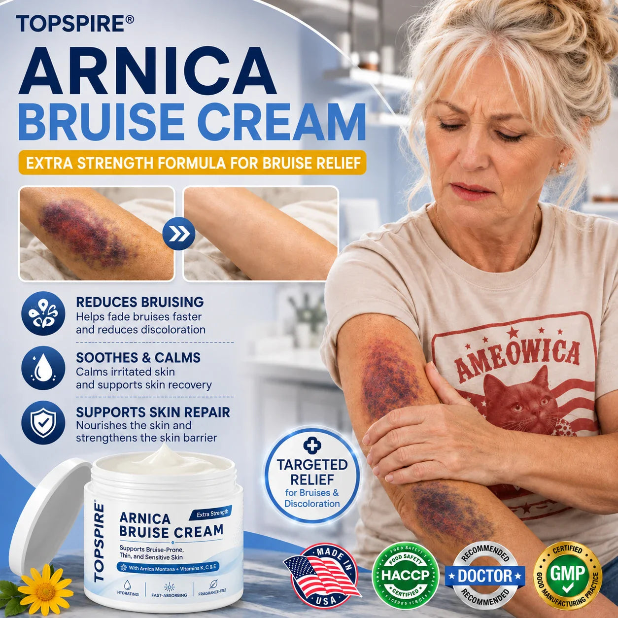 💕 TOPSPIRE® Arnica Bruise Cream