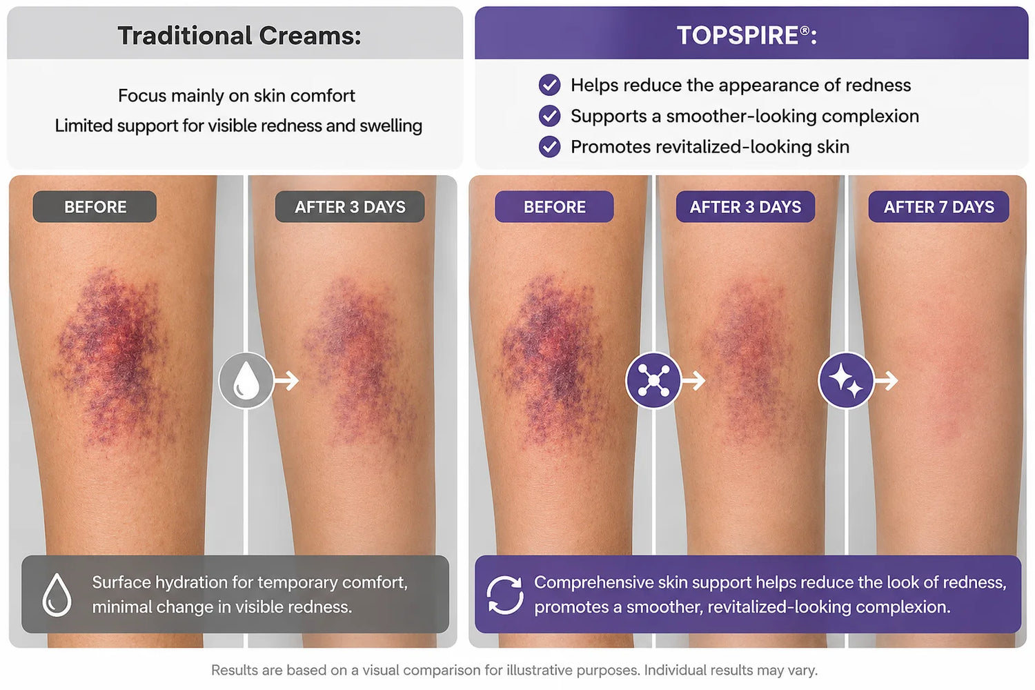 Surface hydration versus comprehensive skin support